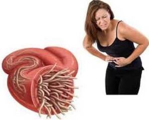 Parassiti nell'intestino di una donna