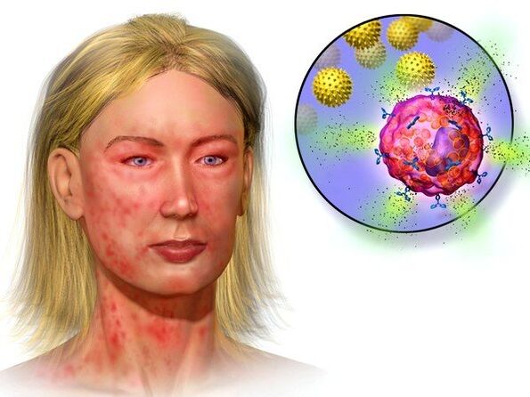 echinococchi e sintomi della loro presenza nel corpo
