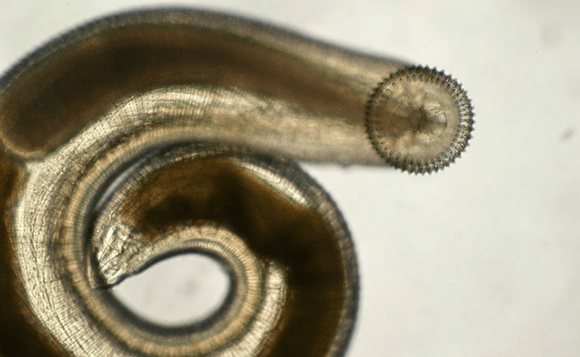 Gnatostoma parassitario sottocutaneo