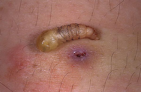 Larva parassita sottocutanea dell'uomo