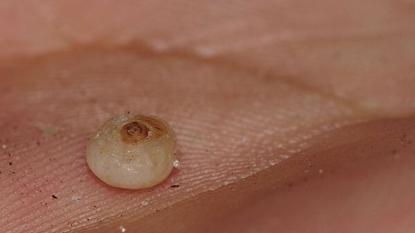 sarcopsillosi con parassiti sottocutanei